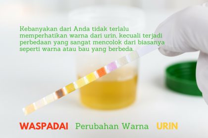 wapada-perubahan-warna-urin urin