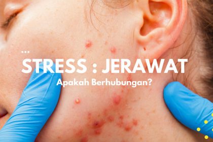 stress_dan_jerawat stress_dan_jerawat