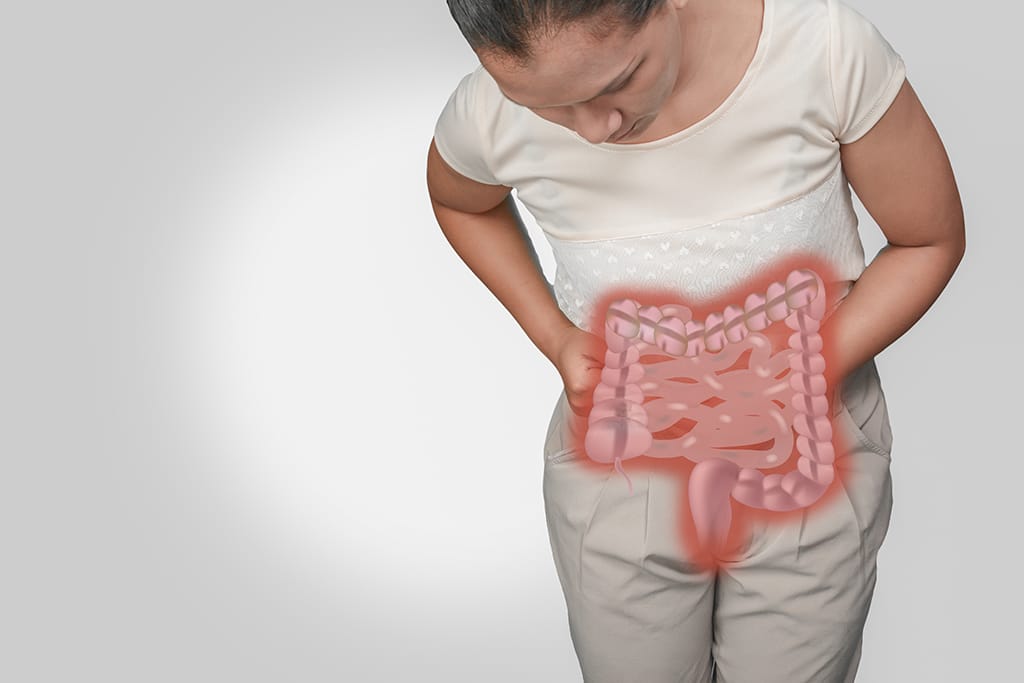 apa itu cacing kremi dan mengatasinya